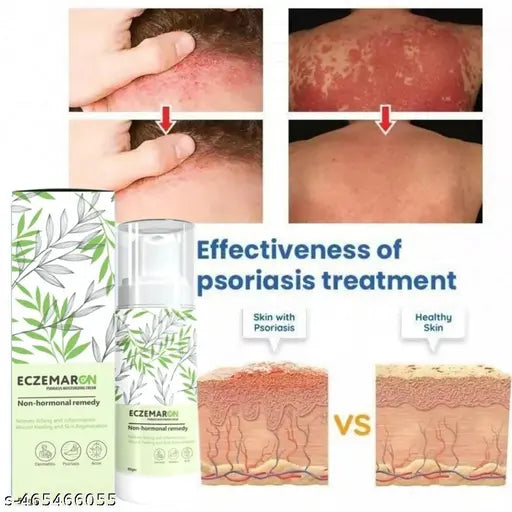 Eczemaron for Ringworm, Itching, Eczema & Fungal Infection Antifungal Cream (Pack of 2)