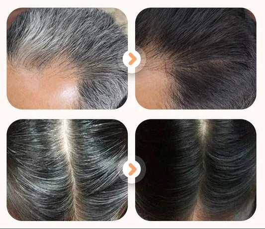 🌿Plant Extract Hair Dye for Gray Hair 200 ml (Buy 1 Get 1 Free)