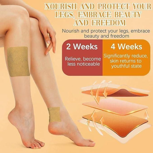 VeinGuard™ - Instant Relief Varicose Vein Patches (Pack of 10)