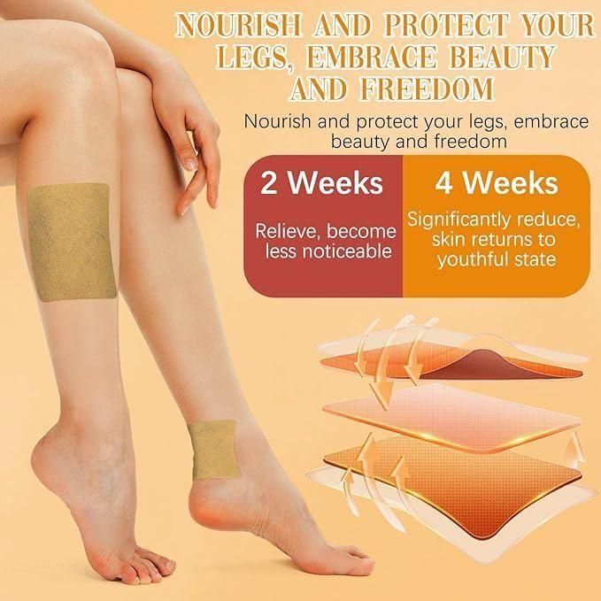 VeinGuard™ - Instant Relief Varicose Vein Patches (Pack of 10)