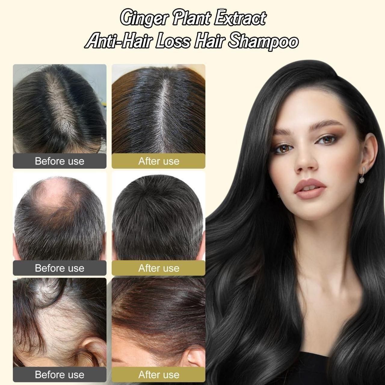 Ginger Plant Extract Anti-Hair Loss Hair Shampoo (PACK OF 3)👈