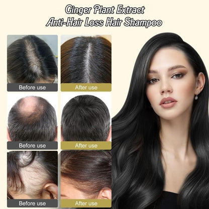 Ginger Plant Extract Anti-Hair Loss Hair Shampoo (PACK OF 3)👈