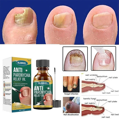 Anti Paronychia Relief Oil - (Buy 1 Get 1 FREE🔥🔥)