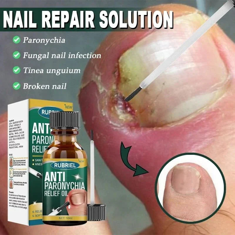 Anti Paronychia Relief Oil - (Buy 1 Get 1 FREE🔥🔥)