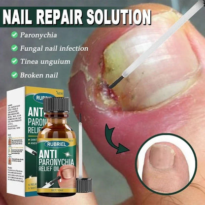 Anti Paronychia Relief Oil - (Buy 1 Get 1 FREE🔥🔥)