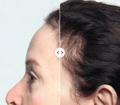 Ginger Plant Extract Anti-Hair Loss Hair Shampoo (PACK OF 3)